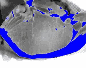 Fat regions produced by excluding areas outside the meat section